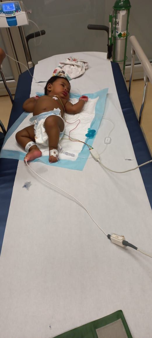 Minuli Akelya 5 months old with Kawasaki Disease